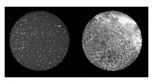 Using the high-resolution microendoscope, doctors can view images of normal (left) and abnormal (right) cervical cells on a cell phone screen.