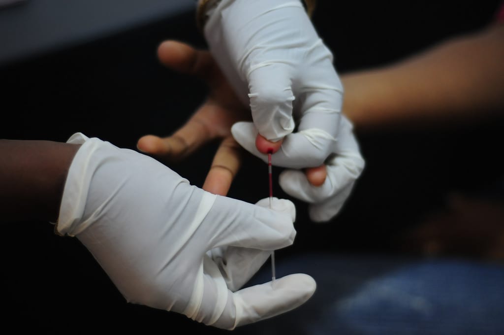 Hands showing lab workers testing for HIV