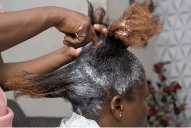 Chemical hair relaxers may contribute to irritation and contact dermatitis; without gloves, hairdressers also risk skin reaction.